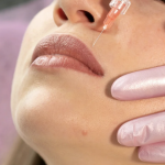 Chevy Chase MD Dermal Filler Experts